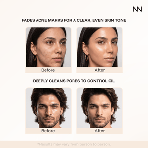 Hydra Facial Cleanser | Damascus Rose Oil & Shea Butter | Hydrating Face Wash for Soft, Refreshed Skin - CINCINNUS
