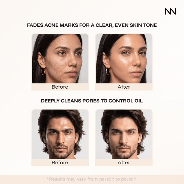 Hydra Facial Cleanser | Damascus Rose Oil & Shea Butter | Hydrating Face Wash for Soft, Refreshed Skin - CINCINNUS