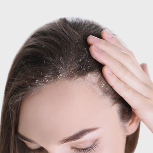 Anti-Itch Anti-Dandruff Hair Mask | Red Algae Extract | Soothes Itchy Scalp & Controls Dandruff | Intensive Scalp Care Treatment